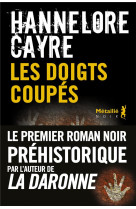 LES DOIGTS COUPES